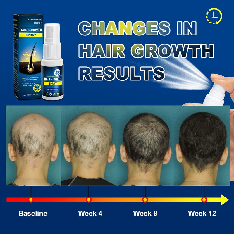 Hair growth essence spray anti-hair loss scalp treatment improvement of hair loss treatment alopecia areata seborrheic alop