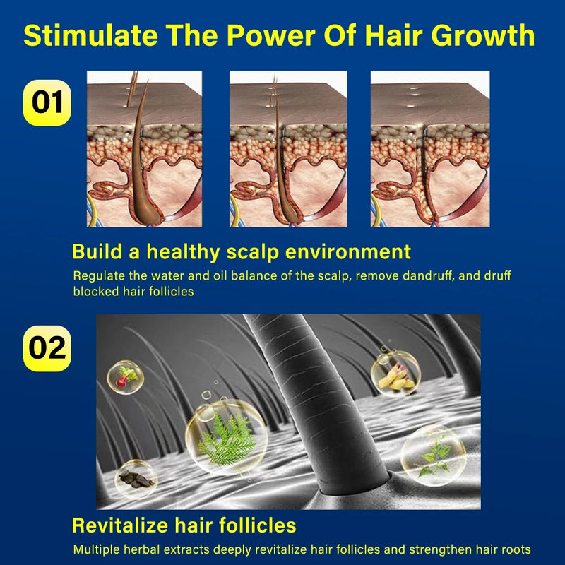 Hair growth essence spray anti-hair loss scalp treatment improvement of hair loss treatment alopecia areata seborrheic alop