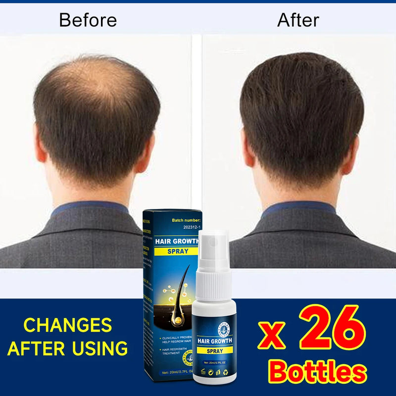 Hair growth essence spray anti-hair loss scalp treatment improvement of hair loss treatment alopecia areata seborrheic alop