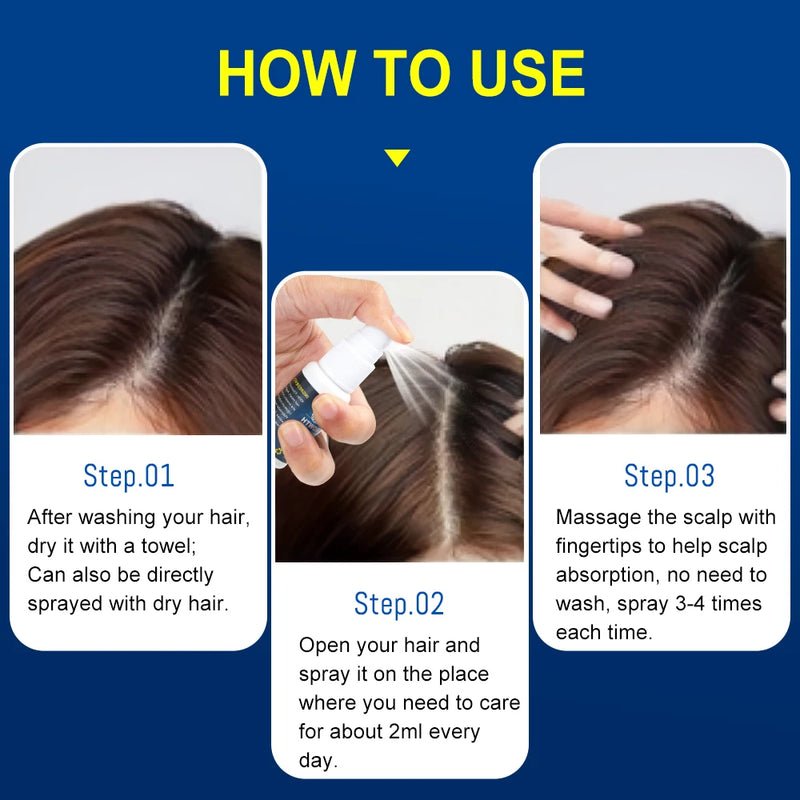 Hair growth essence spray anti-hair loss scalp treatment improvement of hair loss treatment alopecia areata seborrheic alop