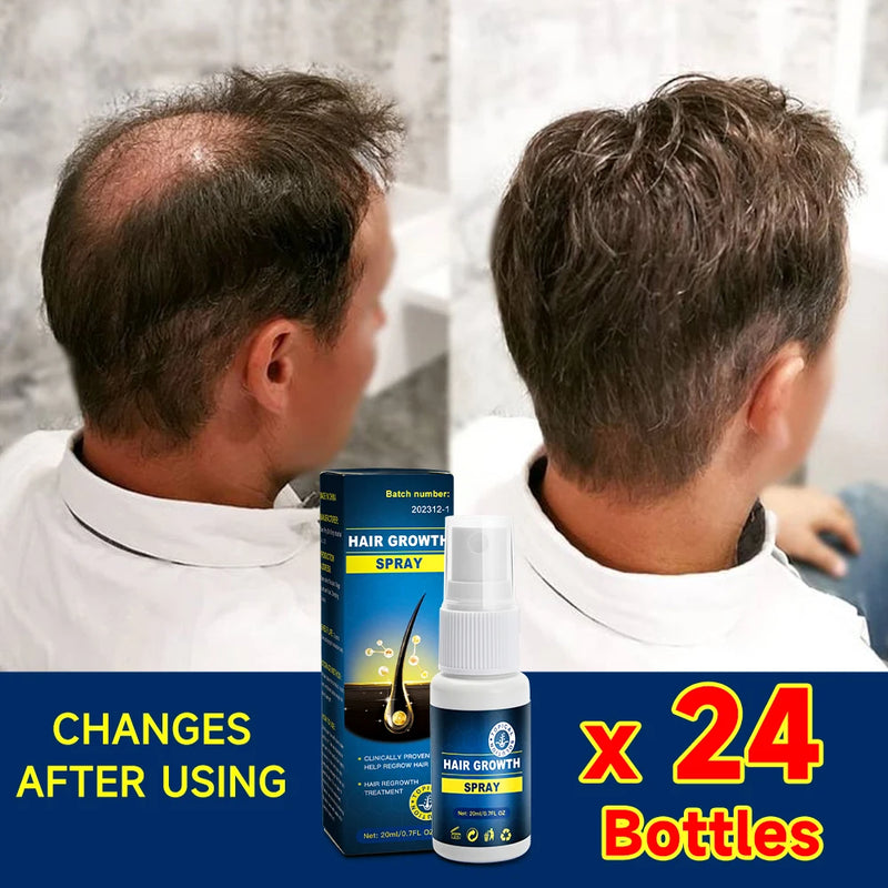 Hair growth essence spray anti-hair loss scalp treatment improvement of hair loss treatment alopecia areata seborrheic alop