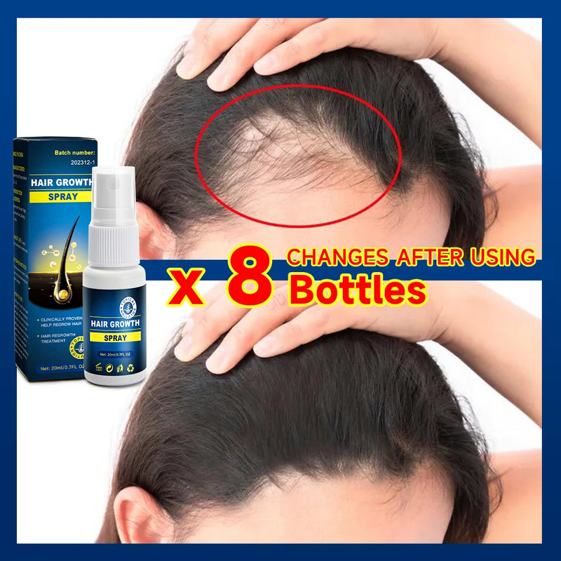 Hair growth essence spray anti-hair loss scalp treatment improvement of hair loss treatment alopecia areata seborrheic alop