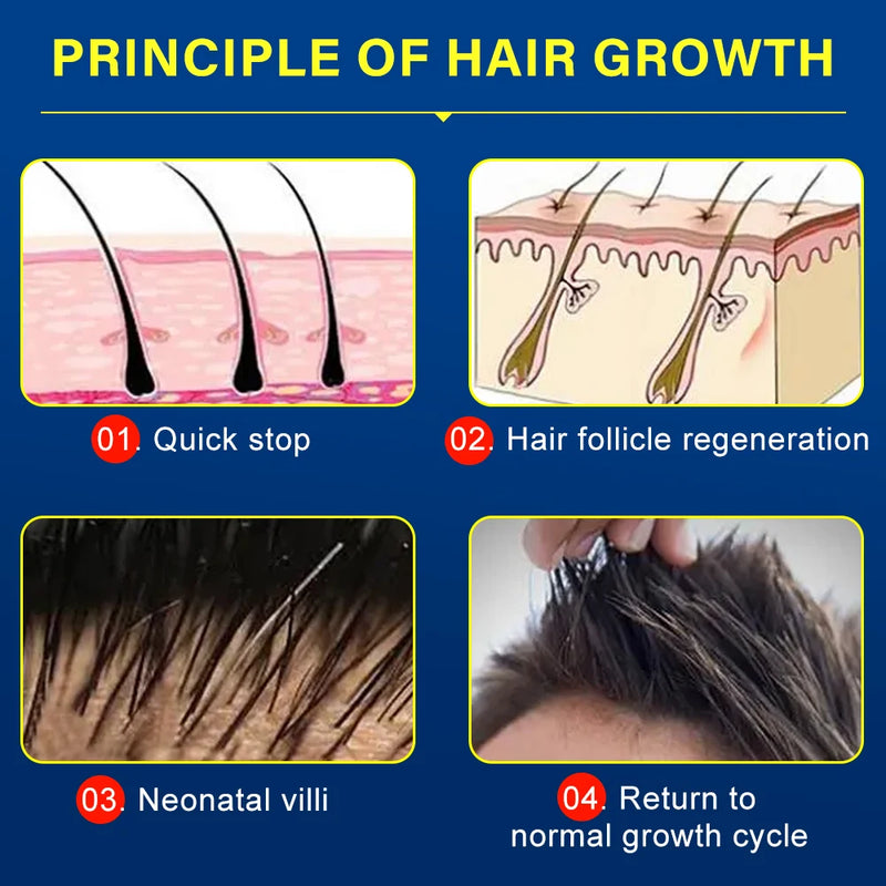 Hair growth essence spray anti-hair loss scalp treatment improvement of hair loss treatment alopecia areata seborrheic alop