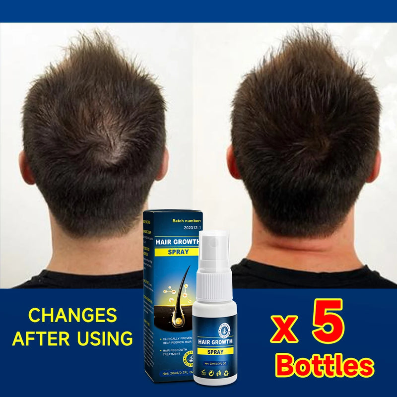 Hair growth essence spray anti-hair loss scalp treatment improvement of hair loss treatment alopecia areata seborrheic alop